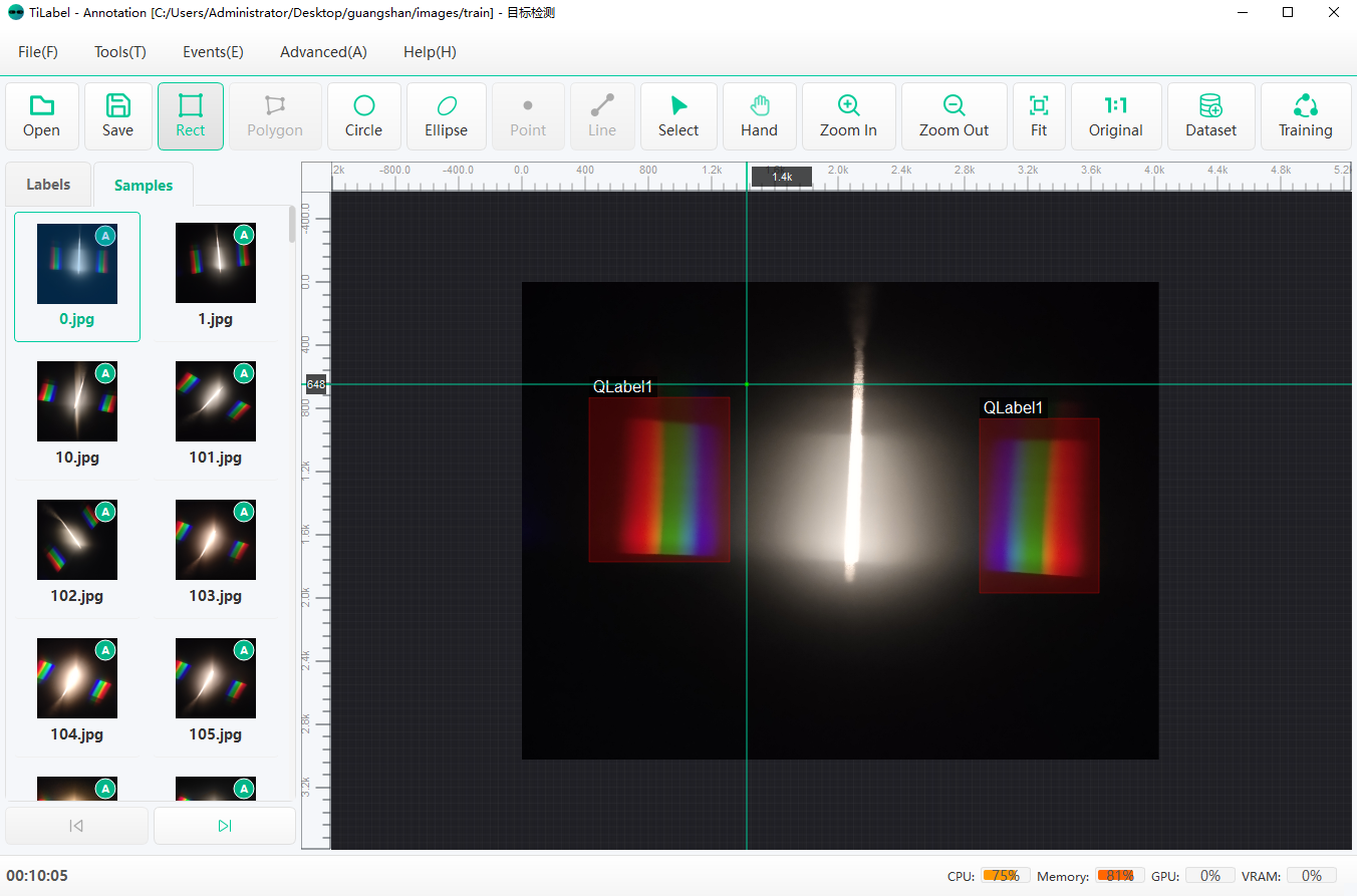 Screenshot 8 of TiVision - Simple Medical Deep Learning Training Annotation Software